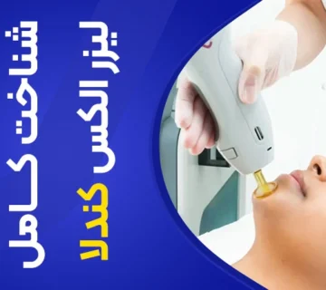 تصویر دستگاه لیزر الکساندرایت کندلا