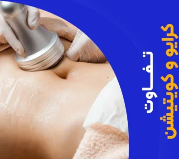 تصویر تفاوت کرایو و کویتیشن