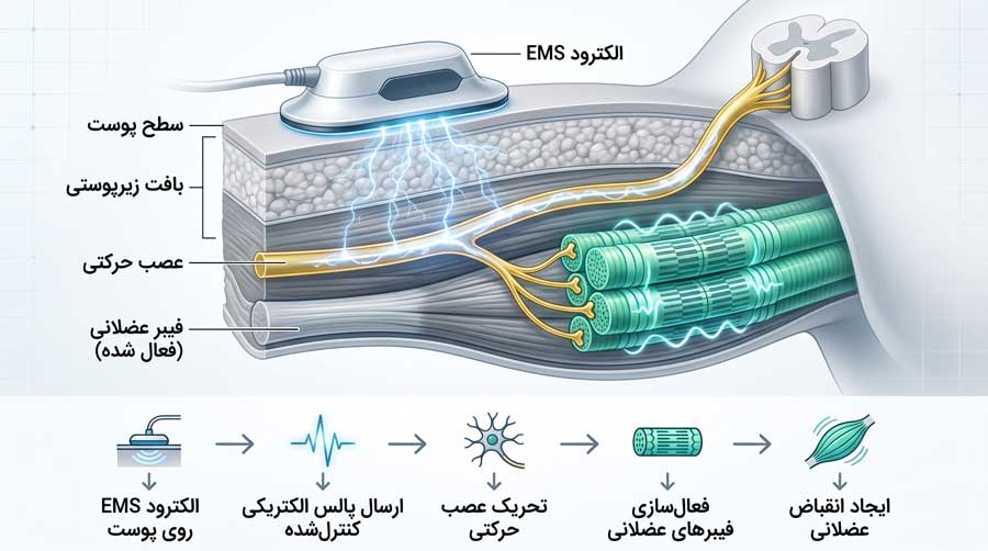 تصویر نحوه عملکرد دستگاه EMS و تحریک عضلات با پالس الکتریکی