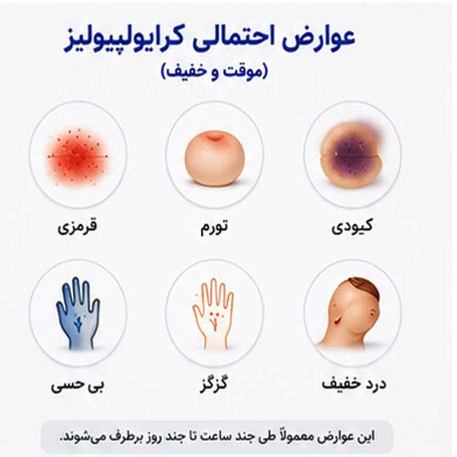 تصویر عوارض احتمالی کرایولیپولیز