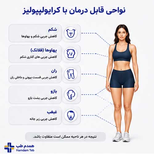 تصویر جوابدهی کرایولیپولیز در نقاط مختلف بدن