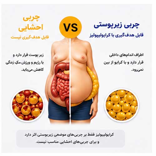 تصویر تفاوت چربی احشایی و چربی زیر پوستی