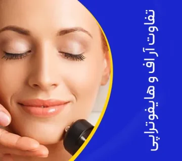 تصویر تفاوت آر اف و کویتیشن