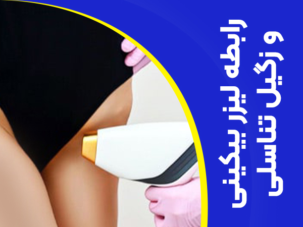تصویر رابطه لیزر بیکینی و زگیل تناسلی