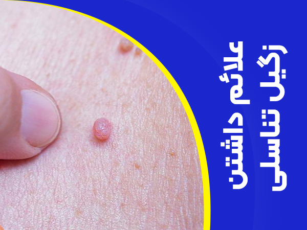 تصویر علائم داشتن زگیل تناسلی