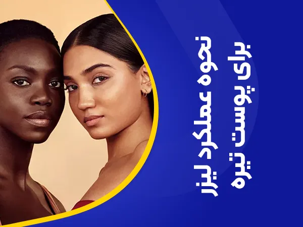 تصویر تحوه عملکرد لیزر بر روی پوست تیره و سبزه