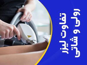 تصویر تفاوت لیزر رولی با شاتی