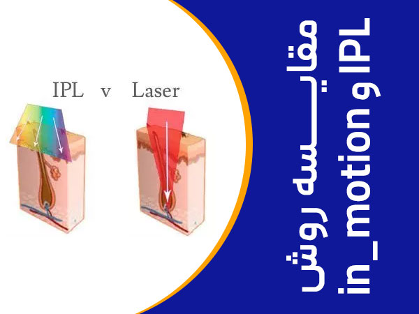 تصویر مقایسه روش in lotion و ipl در لیزر موهای زائد
