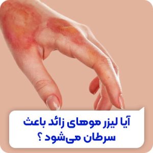 تصویر آیا لیزر موهای زائد باعث سرطان می شود