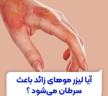 تصویر آیا لیزر موهای زائد باعث سرطان می شود